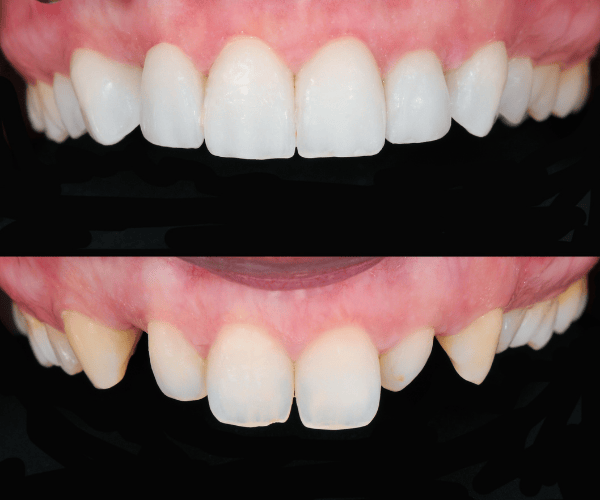 Aesthetic Smile Design